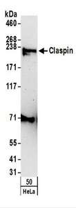 CLSPN / Claspin Antibody - Detection of Human Claspin by Western Blot. Samples: Whole cell lysate (50 ug) from HeLa cells. Antibodies: Affinity purified rabbit anti-Claspin antibody used for WB at 1 ug/ml. Detection: Chemiluminescence with an exposure time of 3 minutes.