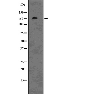 CLSPN / Claspin Antibody - Western blot analysis of Claspin using HuvEc whole cells lysates