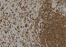 CLSPN / Claspin Antibody - 1:100 staining human gastric tissue by IHC-P. The sample was formaldehyde fixed and a heat mediated antigen retrieval step in citrate buffer was performed. The sample was then blocked and incubated with the antibody for 1.5 hours at 22°C. An HRP conjugated goat anti-rabbit antibody was used as the secondary.