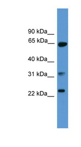CLTA / LCA Antibody - CLTA antibody western blot of Human brain lysate.  This image was taken for the unconjugated form of this product. Other forms have not been tested.