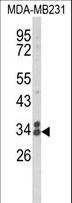 CLTA / LCA Antibody - Western blot of CLTA Antibody in MDA-MB231 cell line lysates (35 ug/lane). CLTA (arrow) was detected using the purified antibody.
