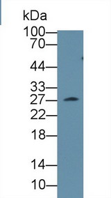 CLTA / LCA Antibody - Western Blot; Sample: Mouse Serum; Primary Ab: 1µg/ml Rabbit Anti-Mouse CLTA Antibody Second Ab: 0.2µg/mL HRP-Linked Caprine Anti-Rabbit IgG Polyclonal Antibody