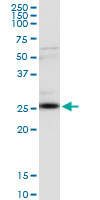 CLTA / LCA Antibody - CLTA monoclonal antibody (M08), clone 4E9. Western Blot analysis of CLTA expression in human kidney.