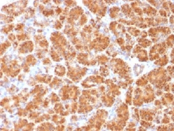 CLTA / LCA Antibody - IHC testing of FFPE human pancreas with Clathrin Light Chain antibody (clone CLC/1421). Required HIER: boil tissue sections in 10mM Citrate buffer, pH 6.0, for 10-20 min.