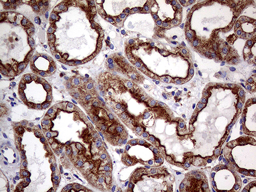 CLTA / LCA Antibody - Immunohistochemical staining of paraffin-embedded Human Kidney tissue within the normal limits using anti-CLTA mouse monoclonal antibody. (Heat-induced epitope retrieval by 1mM EDTA in 10mM Tris buffer. (pH8.5) at 120°C for 3 min. (1:500)