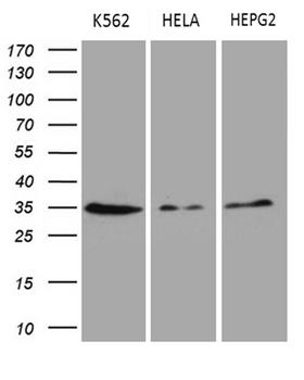 CLTA / LCA Antibody - Western blot analysis of extracts. (35ug) from 3 different cell lines by using anti-CLTA monoclonal antibody. (1:500)
