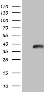 CLTA / LCA Antibody - HEK293T cells were transfected with the pCMV6-ENTRY control. (Left lane) or pCMV6-ENTRY CLTA. (Right lane) cDNA for 48 hrs and lysed