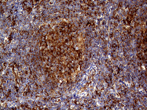 CLTA / LCA Antibody - Immunohistochemical staining of paraffin-embedded Human lymph node tissue within the normal limits using anti-CLTA mouse monoclonal antibody. (Heat-induced epitope retrieval by 1mM EDTA in 10mM Tris buffer. (pH8.5) at 120°C for 3 min. (1:500)