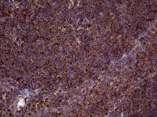CLTA / LCA Antibody - Immunohistochemical staining of paraffin-embedded Human tonsil within the normal limits using anti-CLTA mouse monoclonal antibody. (Heat-induced epitope retrieval by 1mM EDTA in 10mM Tris buffer. (pH8.5) at 120°C for 3 min. (1:2000)