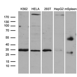 CLTA / LCA Antibody - Western blot analysis of extracts. (35ug) from 4 different cell lines and mouse spleen tissue lysate by using anti-CLTA monoclonal antibody. (1:500)