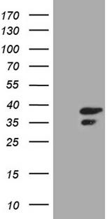 CLTA / LCA Antibody - HEK293T cells were transfected with the pCMV6-ENTRY control. (Left lane) or pCMV6-ENTRY CLTA. (Right lane) cDNA for 48 hrs and lysed. Equivalent amounts of cell lysates. (5 ug per lane) were separated by SDS-PAGE and immunoblotted with anti-CLTA. (1:2000)