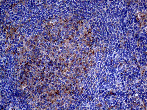 CLTA / LCA Antibody - Immunohistochemical staining of paraffin-embedded Human lymph node tissue within the normal limits using anti-CLTA mouse monoclonal antibody. (Heat-induced epitope retrieval by 1mM EDTA in 10mM Tris buffer. (pH8.5) at 120°C for 3 min. (1:500)