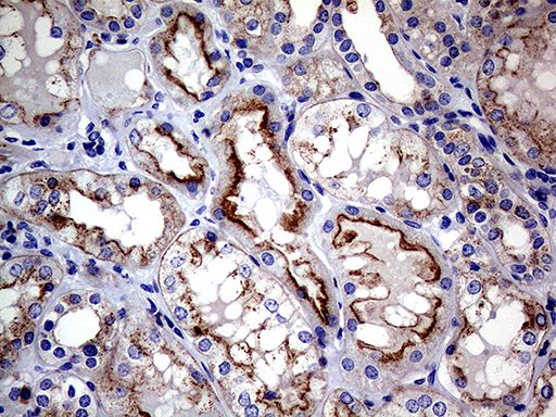 CLTA / LCA Antibody - Immunohistochemical staining of paraffin-embedded Human Kidney tissue within the normal limits using anti-CLTA mouse monoclonal antibody. (Heat-induced epitope retrieval by 1mM EDTA in 10mM Tris buffer. (pH8.5) at 120°C for 3 min. (1:500)