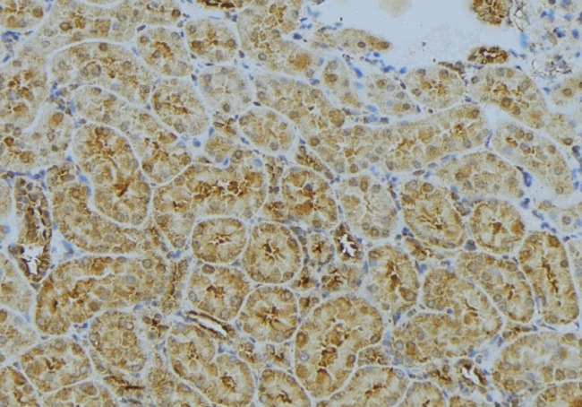 CLTA / LCA Antibody - 1:100 staining mouse kidney tissue by IHC-P. The sample was formaldehyde fixed and a heat mediated antigen retrieval step in citrate buffer was performed. The sample was then blocked and incubated with the antibody for 1.5 hours at 22°C. An HRP conjugated goat anti-rabbit antibody was used as the secondary.