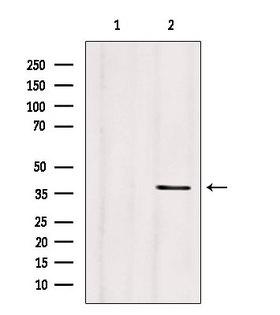 CLTA / LCA Antibody - Western blot analysis of extracts of mouse brain tissue using CLTA antibody. Lane 1 was treated with the blocking peptide.