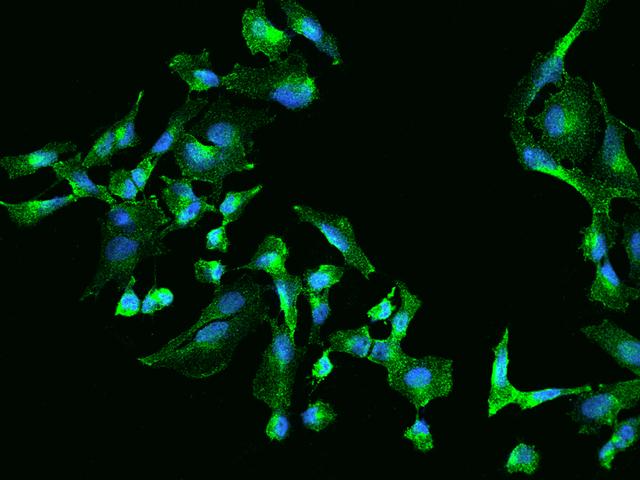 CLTA / LCA Antibody - Immunofluorescence staining of CLTA in U251MG cells. Cells were fixed with 4% PFA, permeabilzed with 0.1% Triton X-100 in PBS, blocked with 10% serum, and incubated with rabbit anti-Human CLTA polyclonal antibody (dilution ratio 1:200) at 4°C overnight. Then cells were stained with the Alexa Fluor 488-conjugated Goat Anti-rabbit IgG secondary antibody (green) and counterstained with DAPI (blue). Positive staining was localized to Cytoplasm.