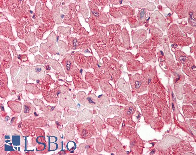 CLTB Antibody - Human Heart: Formalin-Fixed, Paraffin-Embedded (FFPE).  This image was taken for the unconjugated form of this product. Other forms have not been tested.