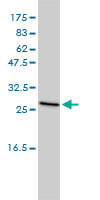 CLTB Antibody - CLTB monoclonal antibody (M01), clone 4B12-1E3 Western blot of CLTB expression in MCF-7.