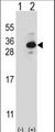 CLTB Antibody - Western blot of CLTB (arrow) using rabbit polyclonal CLTB Antibody. 293 cell lysates (2 ug/lane) either nontransfected (Lane 1) or transiently transfected (Lane 2) with the CLTB gene.