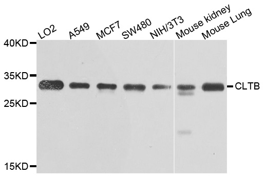CLTB Antibody - Western blot analysis of extracts of various cells.