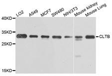 CLTB Antibody - Western blot analysis of extracts of various cells.