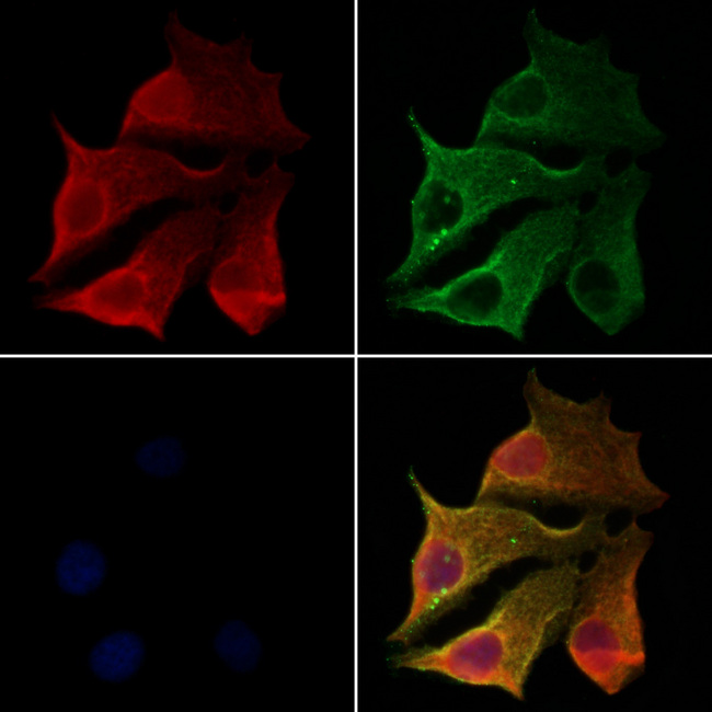 CLTB Antibody - Staining HeLa cells by IF/ICC. The samples were fixed with PFA and permeabilized in 0.1% Triton X-100, then blocked in 10% serum for 45 min at 25°C. Samples were then incubated with primary Ab(1:200) and mouse anti-beta tubulin Ab(1:200) for 1 hour at 37°C. An AlexaFluor594 conjugated goat anti-rabbit IgG(H+L) Ab(1:200 Red) and an AlexaFluor488 conjugated goat anti-mouse IgG(H+L) Ab(1:600 Green) were used as the secondary antibod