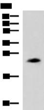 CLTB Antibody - Western blot analysis of NIH/3T3 cell lysate  using CLTB Polyclonal Antibody at dilution of 1:800