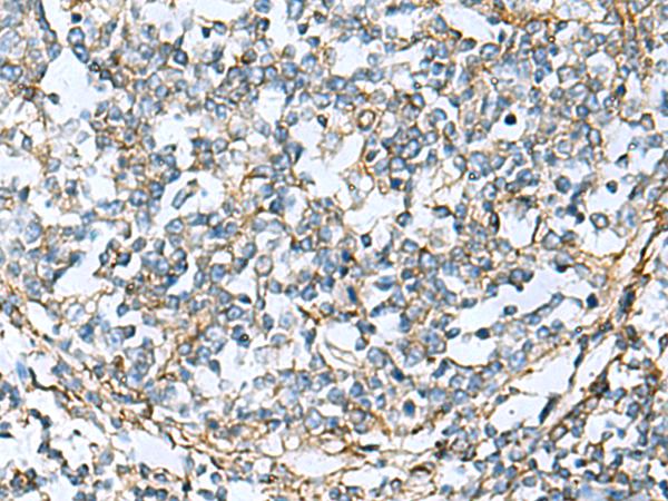 CLTB Antibody - Immunohistochemistry of paraffin-embedded Human tonsil tissue  using CLTB Polyclonal Antibody at dilution of 1:60(×200)