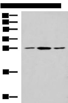 CLTB Antibody - Western blot analysis of NIH/3T3 LO2 and Jurkat cell lysates  using CLTB Polyclonal Antibody at dilution of 1:800
