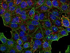 CLTC / Clathrin Heavy Chain Antibody - Immunofluorescence staining of clathrin in human HeLa cell line using anti-clathrin (BF-06; green). Actin cytoskeleton decorated by phalloidin (red) and cell nuclei stained with DAPI (blue).