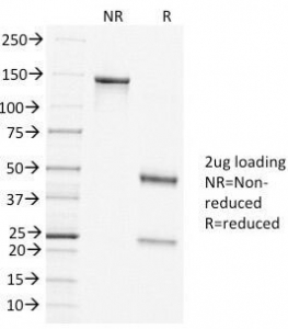 CLTC / Clathrin Heavy Chain Antibody - SDS-PAGE Analysis of Purified, BSA-Free Clathrin Heavy Chain Antibody (clone CLTC/1431). Confirmation of Integrity and Purity of the Antibody.