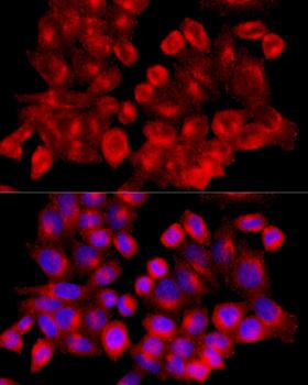 CLTC / Clathrin Heavy Chain Antibody - Immunofluorescence analysis of HeLa cells using CLTC antibody at dilution of 1:100 (40x lens). Blue: DAPI for nuclear staining.