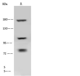 CLTC / Clathrin Heavy Chain Antibody - Anti-CLTC rabbit polyclonal antibody at 1:500 dilution. Lane A: HeLa Whole Cell Lysate. Lysates/proteins at 30 ug per lane. Secondary: Goat Anti-Rabbit IgG (H+L)/HRP at 1/10000 dilution. Developed using the ECL technique. Performed under reducing conditions. Predicted band size: 191 kDa.