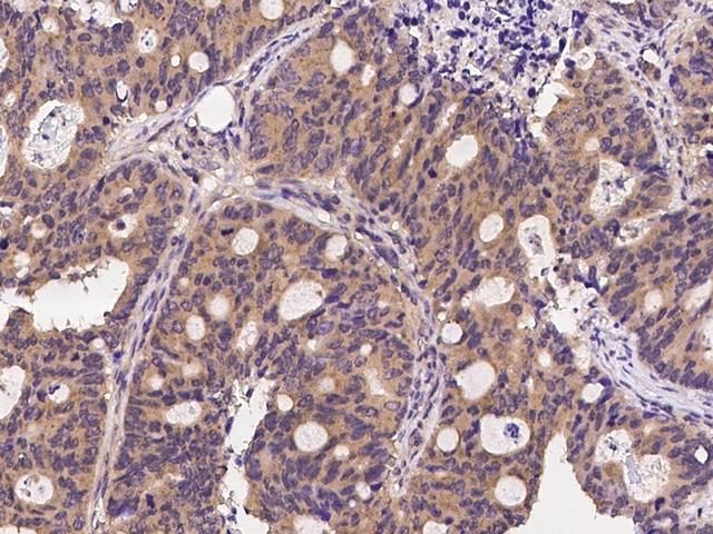 CLTC / Clathrin Heavy Chain Antibody - Immunochemical staining CLTC in human colon with rabbit polyclonal antibody at 1:500 dilution, formalin-fixed paraffin embedded sections.