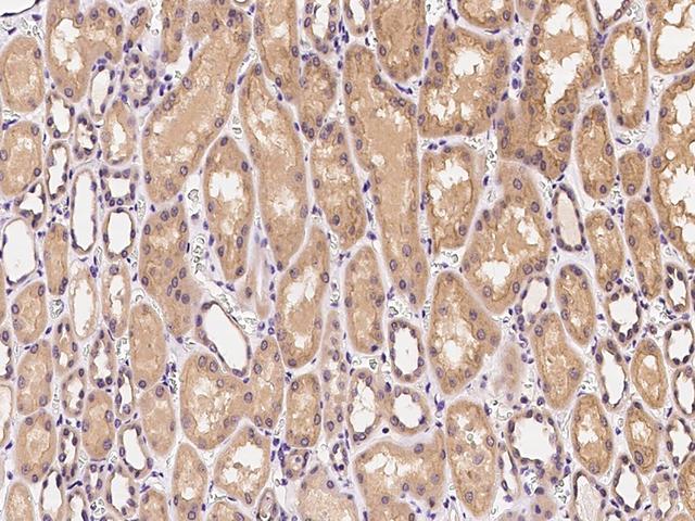 CLTC / Clathrin Heavy Chain Antibody - Immunochemical staining CLTC in human kidney with rabbit polyclonal antibody at 1:500 dilution, formalin-fixed paraffin embedded sections.