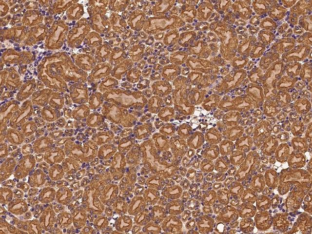 CLTC / Clathrin Heavy Chain Antibody - Immunochemical staining CLTC in mouse kidney with rabbit polyclonal antibody at 1:500 dilution, formalin-fixed paraffin embedded sections.