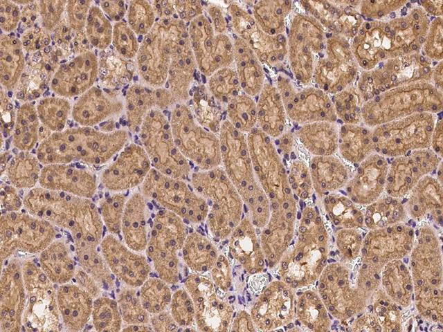 CLTC / Clathrin Heavy Chain Antibody - Immunochemical staining CLTC in rat kidney with rabbit polyclonal antibody at 1:500 dilution, formalin-fixed paraffin embedded sections.