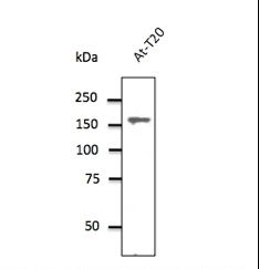 CLTC / Clathrin Heavy Chain Antibody - Endogenous CLTC detected with CLTC antibody at 1:500 dilution. Lysate at 100 ug per lane and rabbit polyclonal to goat IgG (HRP) at 1:10000 dilution.