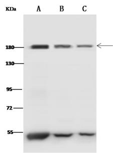 CLTC / Clathrin Heavy Chain Antibody - Anti-CLTC rabbit polyclonal antibody at 1:500 dilution. Lane A: Mouse brain tissue lysate. Lane B: HepG2 Whole Cell Lysate. Lane C: Jurkat Whole Cell Lysate. Lysates/proteins at 30 ug per laneSecondaryGoat Anti-Rabbit IgG (H+L)/HRP at 1/10000 dilution. Developed using the ECL technique. Performed under reducing conditions. Predicted band size: 180 kDa. Observed band size: 180 kDa.