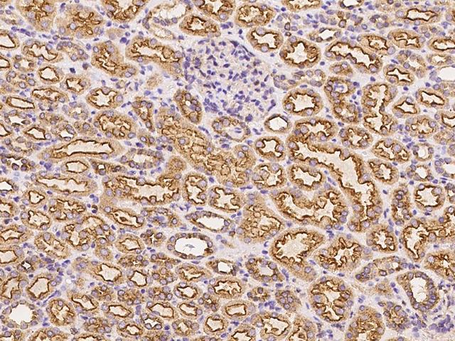 CLTC / Clathrin Heavy Chain Antibody - Immunochemical staining CLTC in human kidney with rabbit polyclonal antibody at 1:1000 dilution, formalin-fixed paraffin embedded sections.