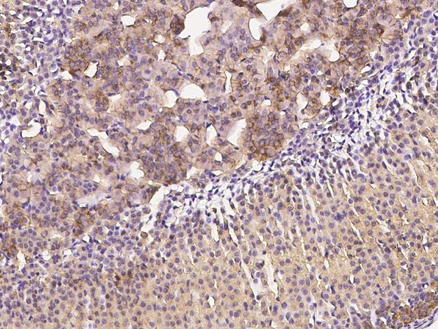 CLTC / Clathrin Heavy Chain Antibody - Immunochemical staining CLTC in mouse adrenal gland with rabbit polyclonal antibody at 1:1000 dilution, formalin-fixed paraffin embedded sections.