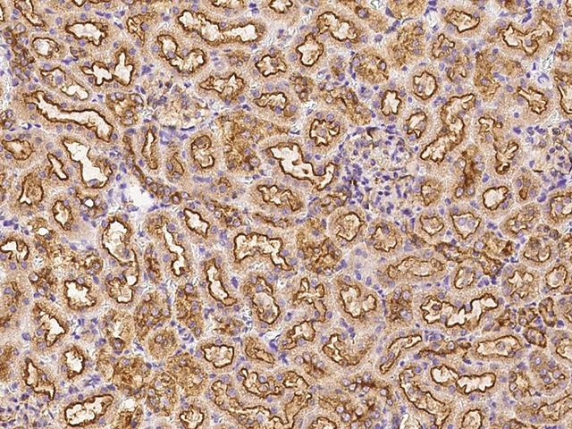 CLTC / Clathrin Heavy Chain Antibody - Immunochemical staining CLTC in rat kidney with rabbit polyclonal antibody at 1:1000 dilution, formalin-fixed paraffin embedded sections.