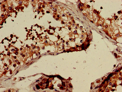 CLTCL1 / CHC22 Antibody - Immunohistochemistry of paraffin-embedded human testis tissue using CLTCL1 Antibody at dilution of 1:100