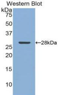 CLU / Clusterin Antibody - Western blot of recombinant CLU / Clusterin.  This image was taken for the unconjugated form of this product. Other forms have not been tested.