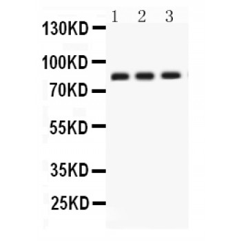 CLU / Clusterin Antibody - Apolipoprotein J antibody Western blot. All lanes: Anti Apolipoprotein J at 0.5 ug/ml. Lane 1: SKOV Whole Cell Lysate at 40 ug. Lane 2: U87 Whole Cell Lysate at 40 ug. Lane 3: PANC Whole Cell Lysate at 40 ug. Predicted band size: 52 kD. Observed band size: 82 kD.