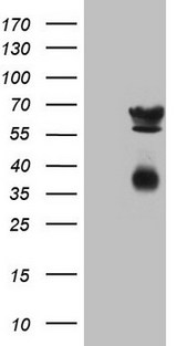 CLU / Clusterin Antibody - HEK293T cells were transfected with the pCMV6-ENTRY control. (Left lane) or pCMV6-ENTRY CLU. (Right lane) cDNA for 48 hrs and lysed. Equivalent amounts of cell lysates. (5 ug per lane) were separated by SDS-PAGE and immunoblotted with anti-CLU. (1:2000)