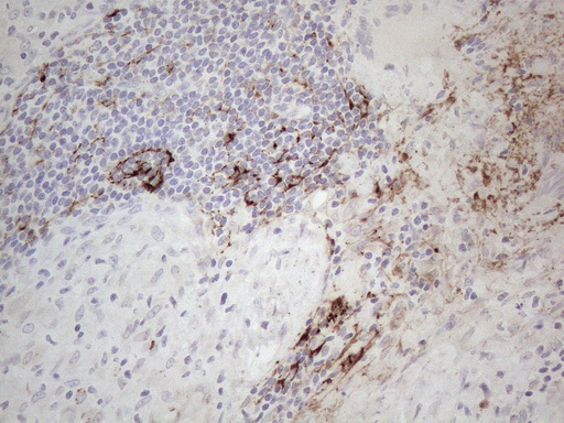 CLU / Clusterin Antibody - Immunohistochemical staining of paraffin-embedded Human lymph node tissue within the normal limits using anti-CLU mouse monoclonal antibody. (Heat-induced epitope retrieval by 1mM EDTA in 10mM Tris buffer. (pH8.5) at 120°C for 3 min. (1:150)