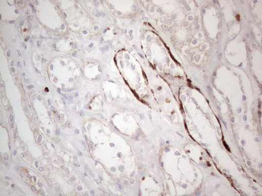 CLU / Clusterin Antibody - Immunohistochemical staining of paraffin-embedded Human Kidney tissue within the normal limits using anti-CLU mouse monoclonal antibody. (Heat-induced epitope retrieval by 1mM EDTA in 10mM Tris buffer. (pH8.5) at 120°C for 3 min. (1:150)
