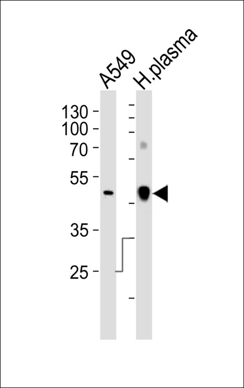 CLU / Clusterin Antibody - Western blot of lysates from A549 cell line and human plasma tissue lysate(from left to right), using CLU Antibody. Antibody was diluted at 1:1000 at each lane. A goat anti-rabbit IgG H&L (HRP) at 1:10000 dilution was used as the secondary antibody. Lysates at 35ug per lane.
