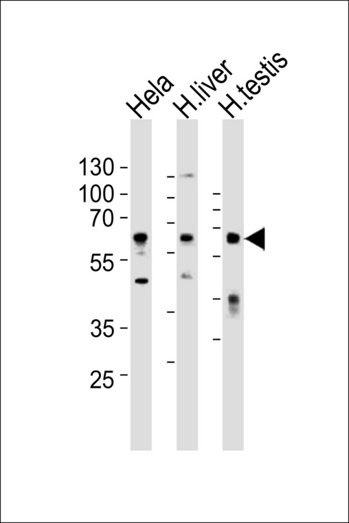 CLU / Clusterin Antibody - Western blot of lysates from HeLa cell line, human liver and human testis tissue lysate(from left to right), using CLU Antibody. Antibody was diluted at 1:1000 at each lane. A goat anti-rabbit IgG H&L (HRP) at 1:10000 dilution was used as the secondary antibody. Lysates at 35ug per lane.